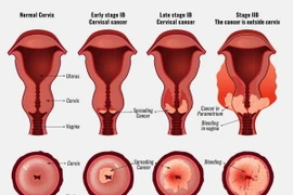 (Ảnh minh họa. Nguồn: singingriverhealthsystem)