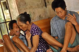 Bà Tạ Thị Chuyên chăm sóc cho con bị ảnh hưởng bởi chất độc da cam. (Ảnh: Minh Đức/TTXVN)
