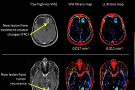 Ảnh chỉ có tính minh họa. (Nguồn: indexsmart.mirasmart.com)