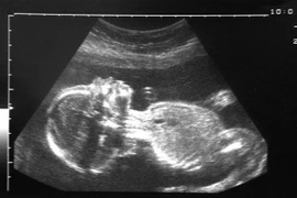 Hình ảnh về thai nhi. (Nguồn: Telegraph)