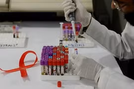 Công tác nghiên cứu về bệnh HIV/AIDS đang có nhiều tiến triển. (Nguồn: Getty)