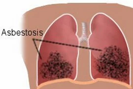 Ảnh minh họa. (Nguồn: northerninsulation.com)