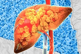 Ảnh minh họa. (Nguồn: BioSpace)