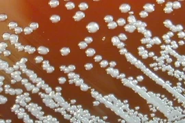 Vi khuẩn Burkholderia pseudomallei gây bệnh Whitmore. (Nguồn: CNN)