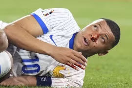 Mbappe dính chấn thương mũi trong trận Pháp thắng Áo 1-0. (Nguồn: X)