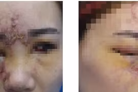 Bệnh nhân khi tới khám tại Bệnh viện Da liễu Trung ương. (Ảnh: PV/Vietnam+)