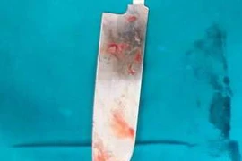 Con dao đâm vào sâu cơ thể của nạn nhân. (Ảnh: Bác sỹ cung cấp)