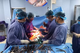 Các bác sỹ phẫu thuật cho bệnh nhân. (Ảnh: PV/Vietnam+)