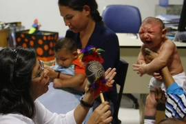 Trẻ em bị mắc chứng bệnh đầu nhỏ do nhiễm virus Zika được điều trị tại Brazil. (Ảnh: THX/TTXVN)