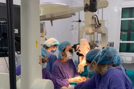 Các bác sỹ thực hiện ca phẫu thuật tạo hình cho bệnh nhân 9 tuổi. (Ảnh: PV/Vietnam+)