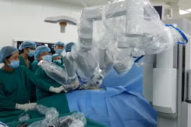 Kíp bác sỹ chuẩn bị thực hiện ca phẫu thuật nội soi cắt thận có sự hỗ trợ của robot. (Ảnh: TTXVN phát)