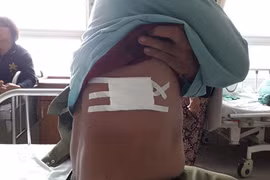 Thăm hỏi hai "hiệp sỹ" bị thương khi truy bắt tội phạm ở Đồng Nai
