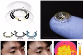 (Nguồn: en.yna.co.kr)