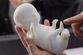 Công nghệ in 3D đem tới mô hình vô cùng chân thực của thai nhi