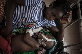 Bệnh nhân nhiễm HIV điều trị tại bệnh viện ở Bangui của Cộng hòa Trung Phi. (Ảnh: AFP/TTXVN)