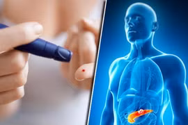 Ô nhiễm không khí làm tăng nguy cơ mắc bệnh tiểu đường. 