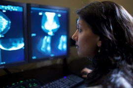 Anh thừa nhận thiếu sót trong chương trình sàng lọc ung thư vú. (Nguồn: News Zedid)