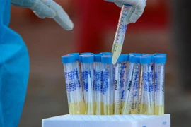 Lấy mẫu xét nghiệm. (Ảnh minh họa: Trần Lê Lâm/TTXVN)