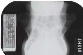 Bản chụp X-quang của Marilyn Monroe. (Nguồn: AP) 