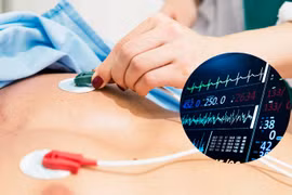 Phương pháp mới giúp chẩn đoán nhanh chứng nhồi máu cơ tim