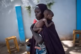 Trẻ em bị suy dinh dưỡng tại Maiduguri, Nigeria. (Nguồn: AFP/TTXVN)