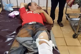 Ông Phan Ngọc Khoa, Hạt phó Hạt Kiểm lâm Krông Nô bị xe càng cán qua chân khi tham gia bắt giữ gỗ lậu. (Ảnh: Hưng Thịnh/TTXVN)