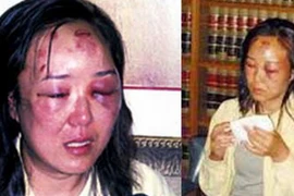 Bà Zhao Yan bị đánh dã man do bị nhầm là một tay buôn lậu ma túy. (Nguồn: shanghaiist.com)