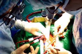 Cứu sống bệnh nhân bị dao đâm xuyên qua phổi đến tim