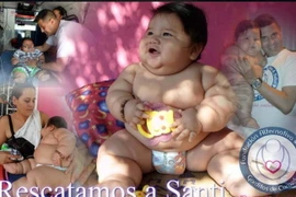 Bé trai béo nhất Colombia được điều trị giảm cân