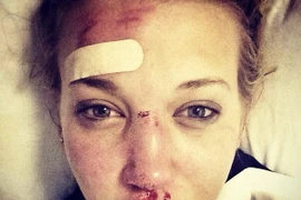 Olympic Sochi: Nữ vận động viên 18 tuổi người Anh bất tỉnh