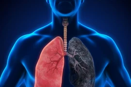 Ảnh chỉ có tính minh họa. (Nguồn: ivcnorthwest.com)