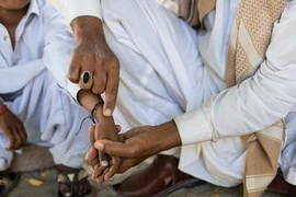 Một trẻ em nhiễm HIV sau khi được tiêm bởi bác sỹ Muzaffar Ghanghro. (Nguồn: nytimes)