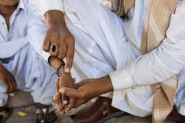 Một trẻ em nhiễm HIV sau khi được tiêm bởi bác sỹ Muzaffar Ghanghro. (Nguồn: nytimes)