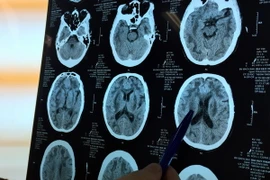 Hội chẩn điều trị cho bệnh nhân ngộ độc Methanol. (Ảnh minh họa: TTXVN phát)