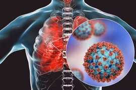 Virus SARS-CoV-2 tấn công khiến phổi bị suy giảm chức năng hô hấp. (Ảnh: Science Photo) 
