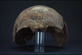 Xương của người đàn ông thời kỳ săn bắn hái lượm 5.000 năm trước. (Ảnh: Đại học Kiel)