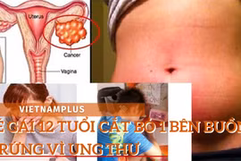 Cuộc chiến với ung thư buồng trứng của cô bé 12 tuổi
