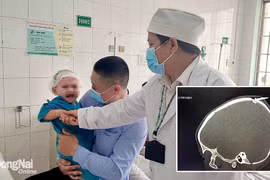 Đồng Nai: Cứu sống bé trai 2 tuổi bị đinh đâm qua xương sọ