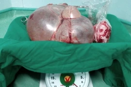 (Ảnh minh họa: Tâm Huệ/TTXVN)