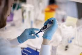 Biological E. dự định từ tháng 8 tới sẽ sản xuất 75-80 triệu liều vaccine mỗi tháng. (Nguồn: AFP)