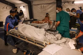 Điều trị cho trẻ em bị thương sau cuộc không kích do Israel tiến hành tại Dải Gaza. (Ảnh: AFP/TTXVN)