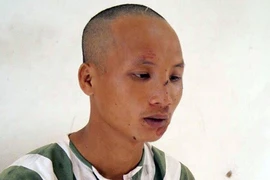 Bình Dương: Hai người dân bị thương khi truy bắt kẻ cướp giật