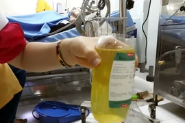 Mẫu bệnh phẩm của 3 bệnh nhân ngộ độc rượu ngâm củ ấu tàu. (Ảnh: Bùi Đức Hiếu/TTXVN)