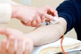 Xét nghiệm máu có thể giúp ngăn chặn bệnh Alzheimer