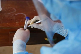 Ngày 2/4: Ghi nhận 65.619 ca nhiễm mới COVID-19, 37 ca tử vong