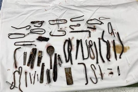 Hàng chục mảnh kim loại được lấy ra từ dạ dày của bệnh nhân. (Ảnh: TTXVN phát)