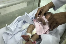 Bệnh nhi vẫn đang được tiếp tục theo dõi, điều trị tại Bệnh viện Nhi đồng 1. (Ảnh: Đinh Hằng/TTXVN)