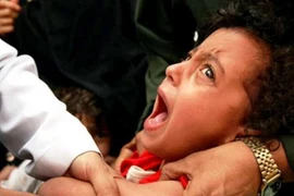 Mỹ: Nguy cơ bùng phát bệnh sởi tại bang California