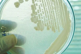 Nấm Candida auris. (Nguồn: Sciencealert)
