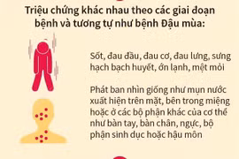 Bệnh Đậu mùa Khỉ: Triệu chứng và các biện pháp phòng bệnh
